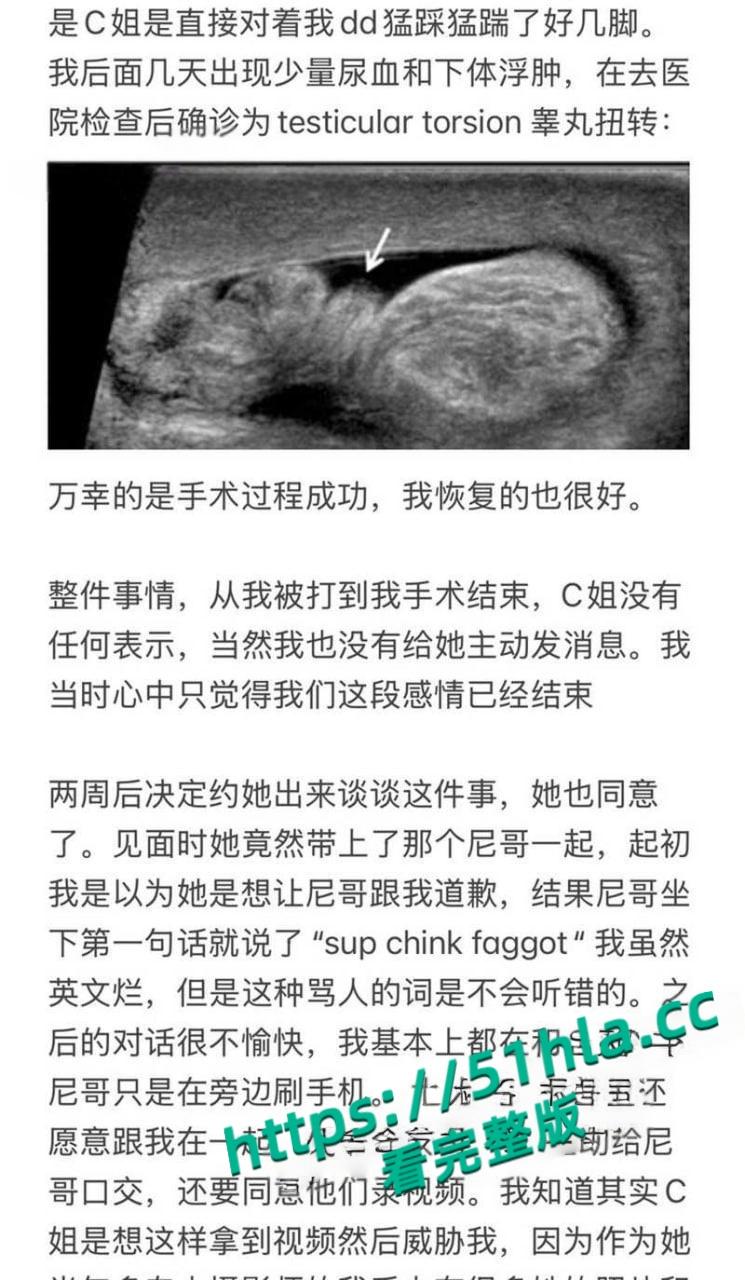 北美名校顶级媚黒骚逼【Caroline】淫乱大瓜，勾搭巨屌黑人3P逼绿帽男友吞精踢爆睾丸，野战后入偷拍视频曝光！-9