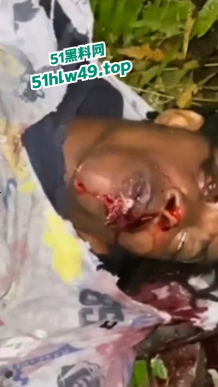 血腥恐怖，非洲南部车祸乡间公路步行，司机未看清路况当场将撞飞路人，手脚全断死相极其残忍。-2