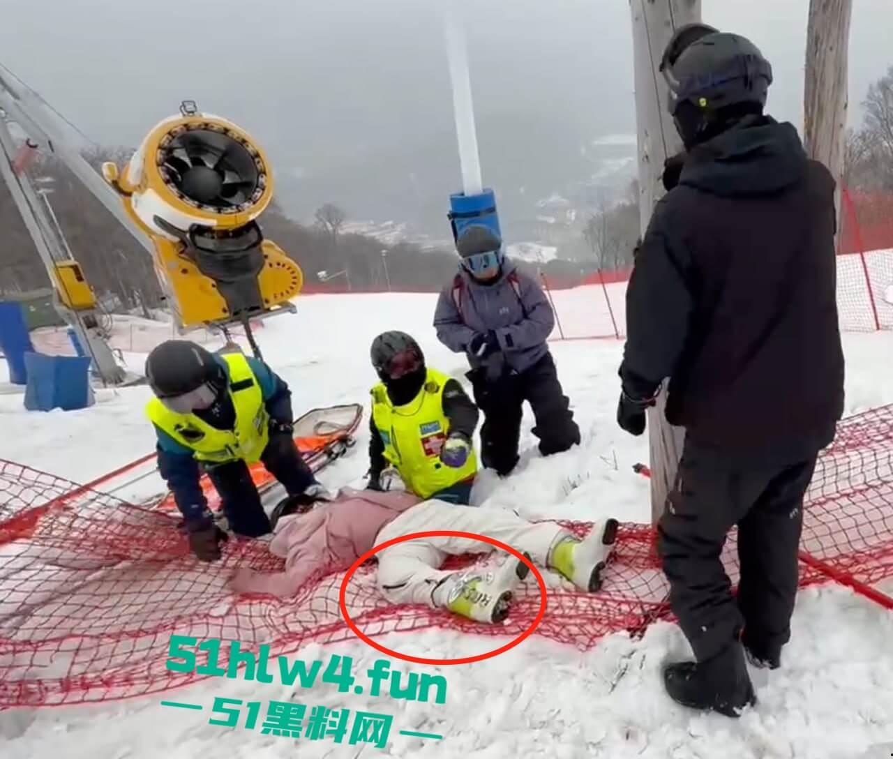 北大湖滑雪场新手滑雪妹，误入中高级滑道滑雪，不慎摔飞被撞到变形断腿场面超吓人。-2