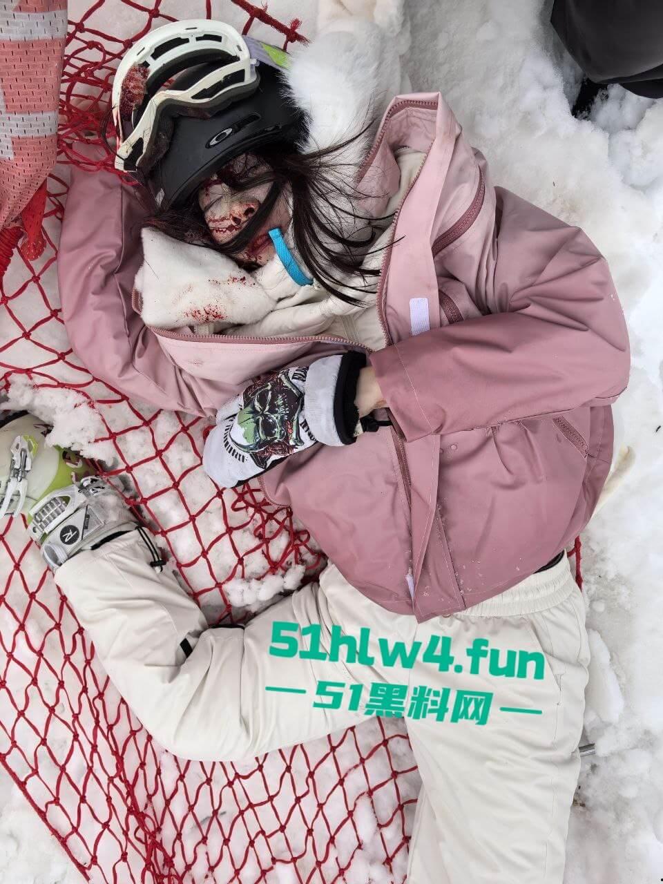 北大湖滑雪场新手滑雪妹，误入中高级滑道滑雪，不慎摔飞被撞到变形断腿场面超吓人。-9