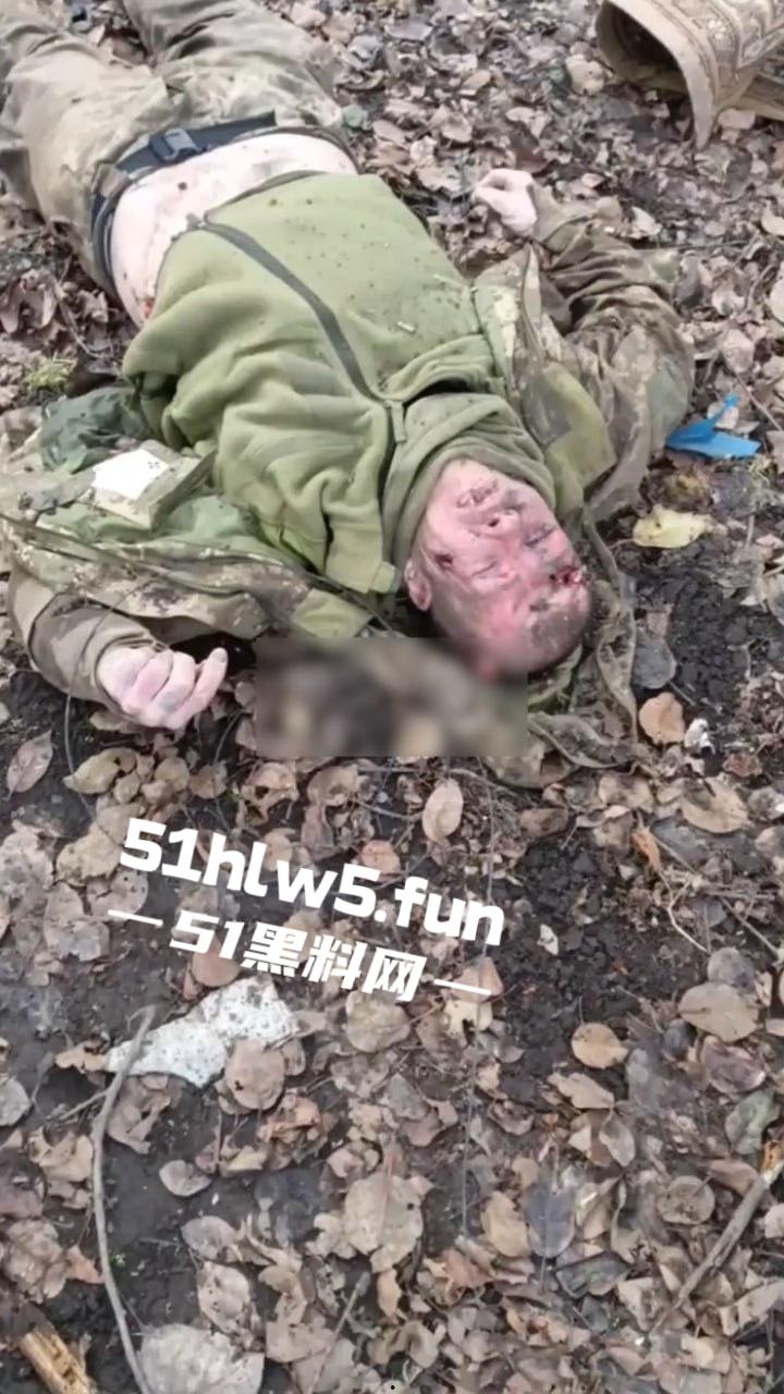 【血腥恐怖】俄乌战场战后清扫,到处都是早已腐烂的士兵尸体,现场视频画面流出。-9