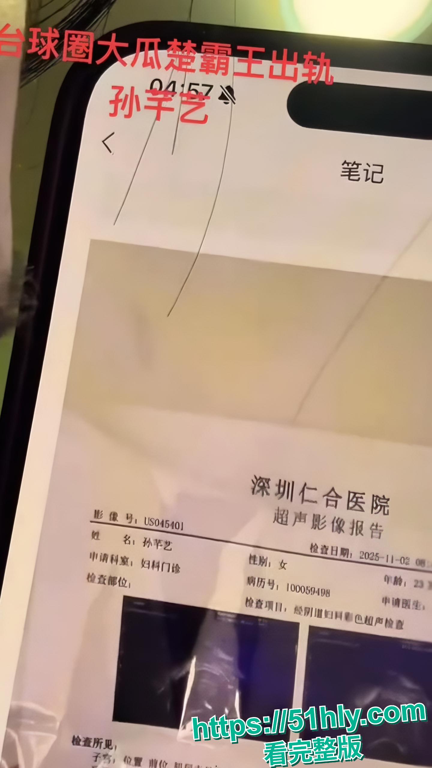 台球圈传出大瓜!国家队选手楚秉杰婚内出轨孙芊艺 怀孕流产后被勒索200万封口费 不雅视频全网疯传 球台上的准头全用到床上了-17